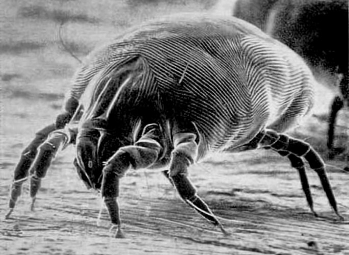 unseen danger the house dust mite